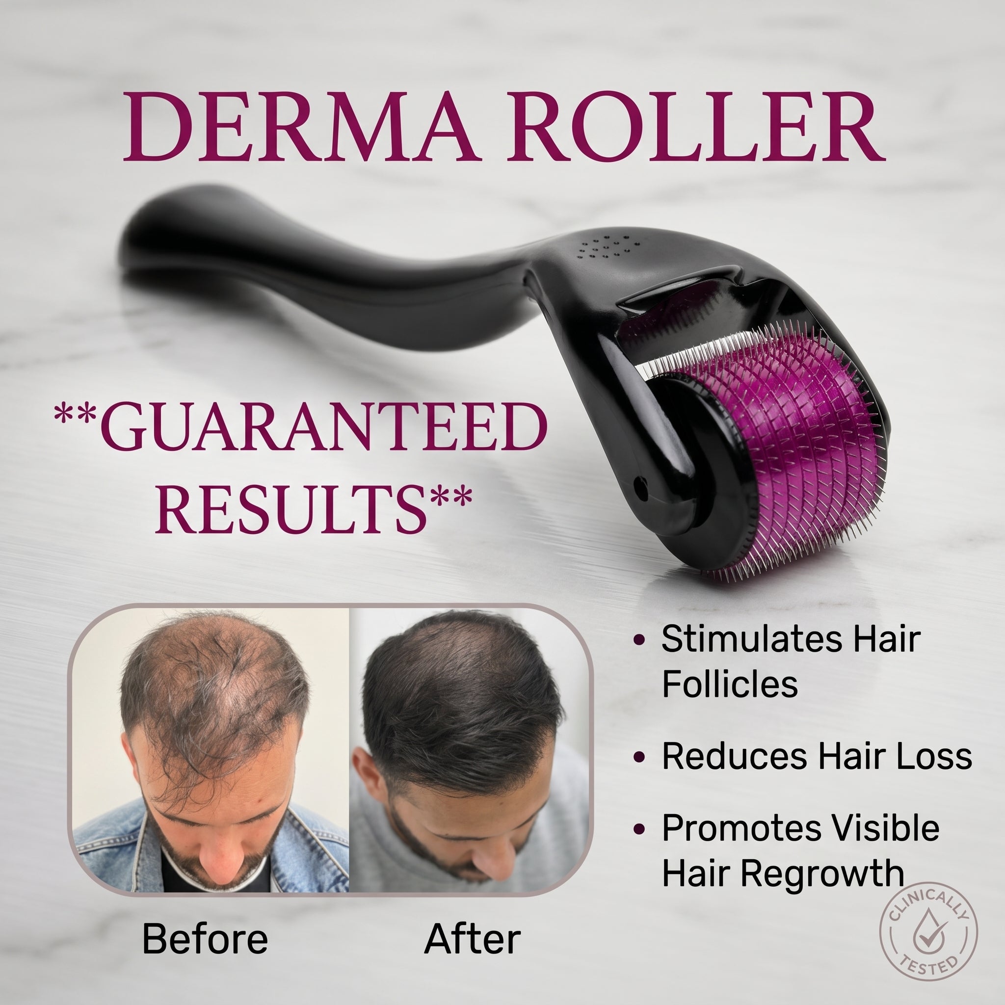 Derma Roller for hair growth